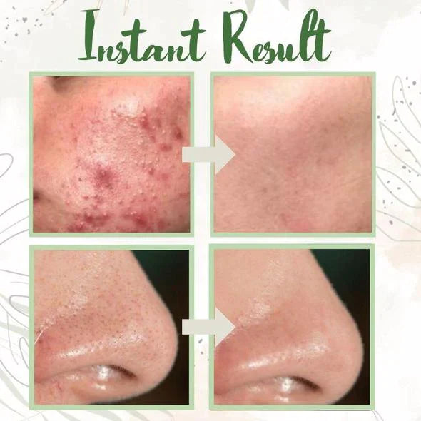 Rockzme® Green Tea Pore Reset Mask Stick